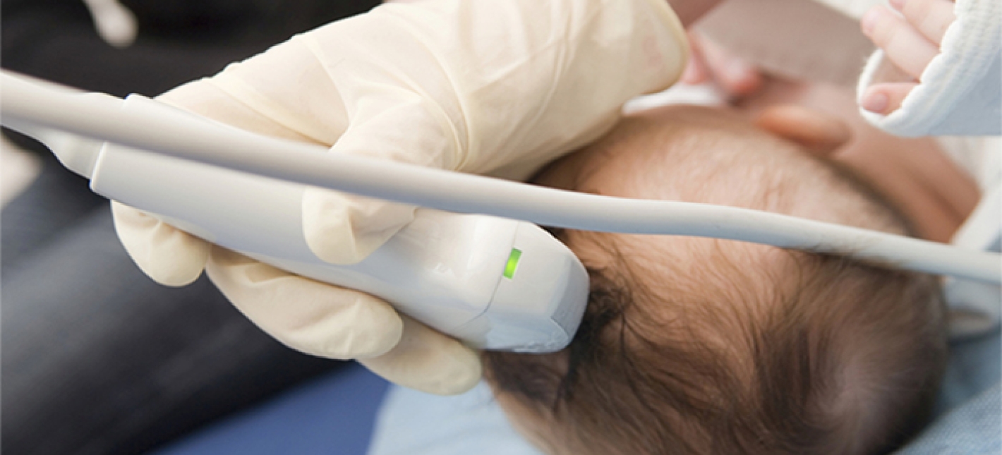 УЗИ головного мозга новорожденного 