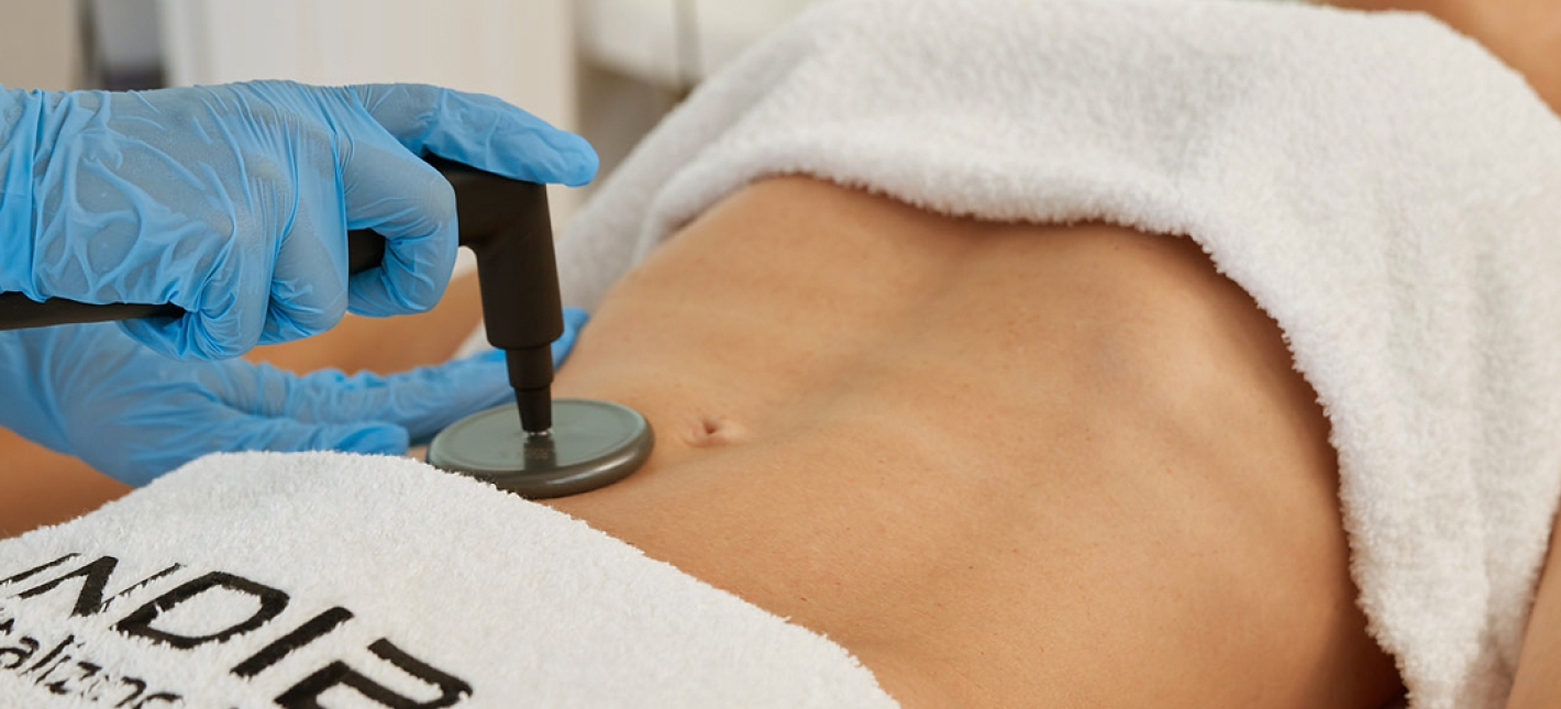 Текар-терапия INDIBA — инновационная физиотерапевтическая методика в гинекологии 