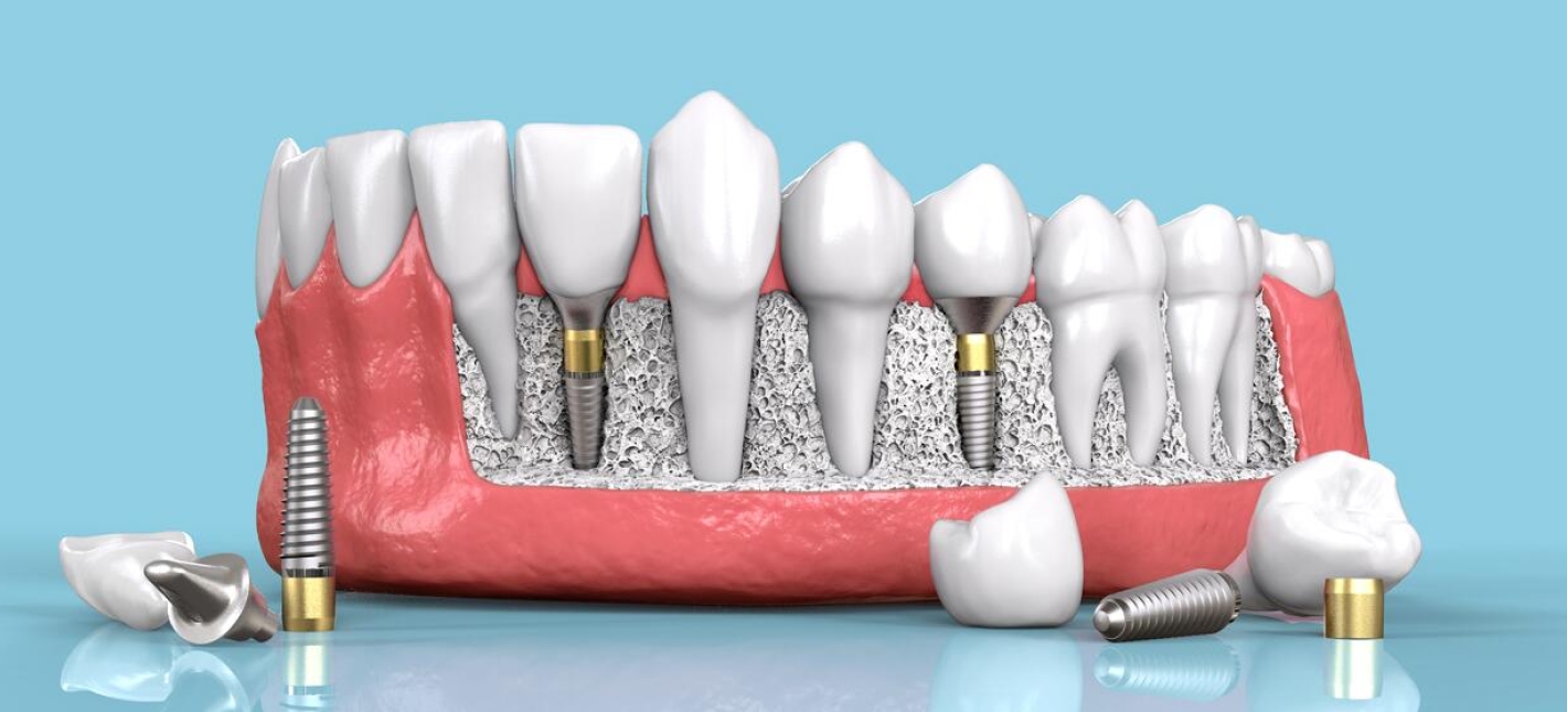 Ортопедическая стоматология