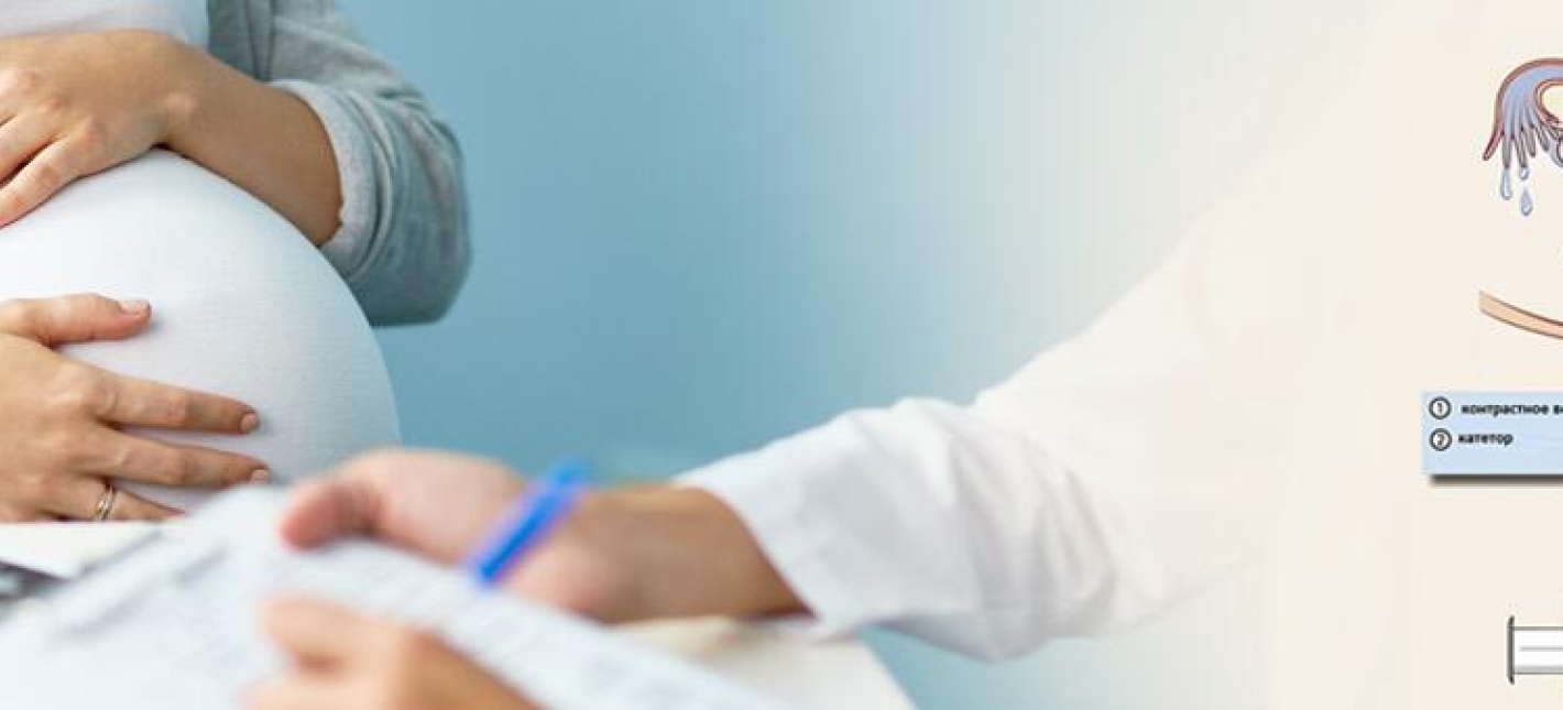 Соногистеросальпингоскопия