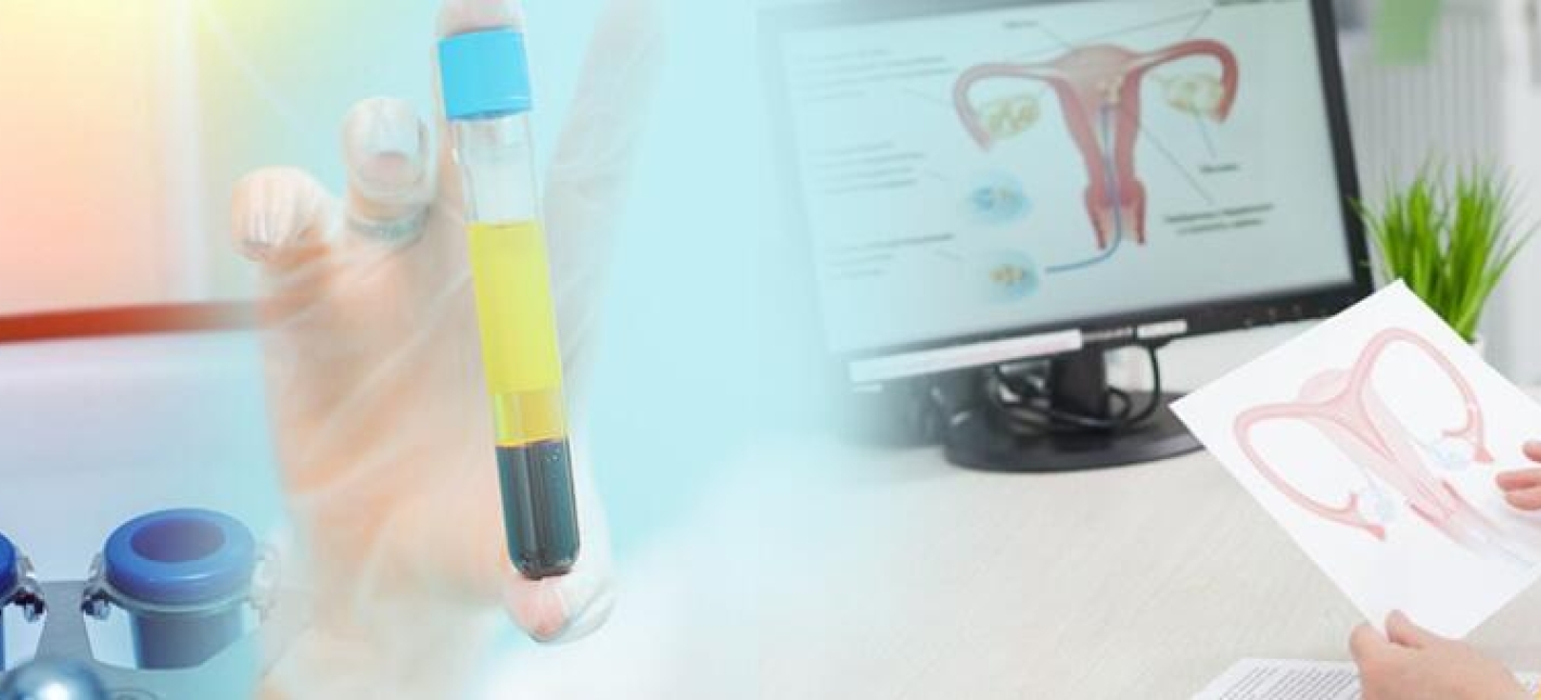 Интимная PRP-терапия (плазмотерапия) в гинекологии