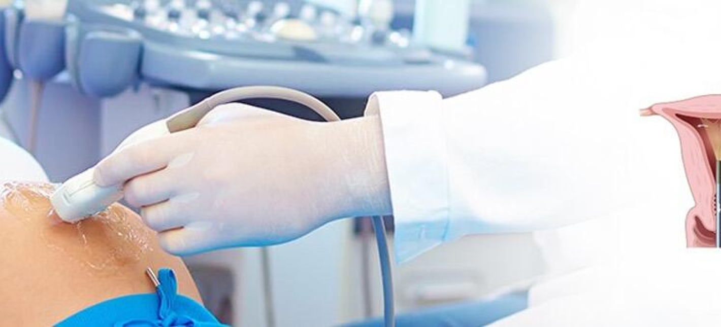 Цервикометрия