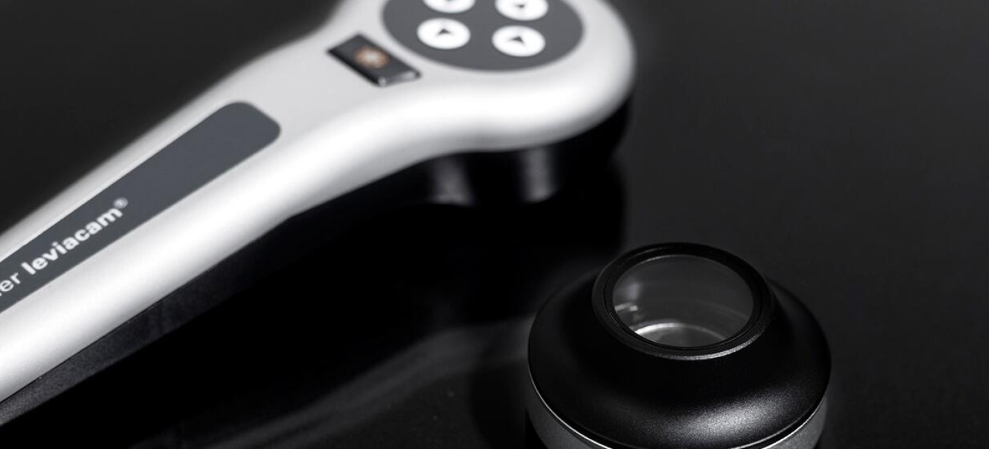 Компьютерная трихоскопия