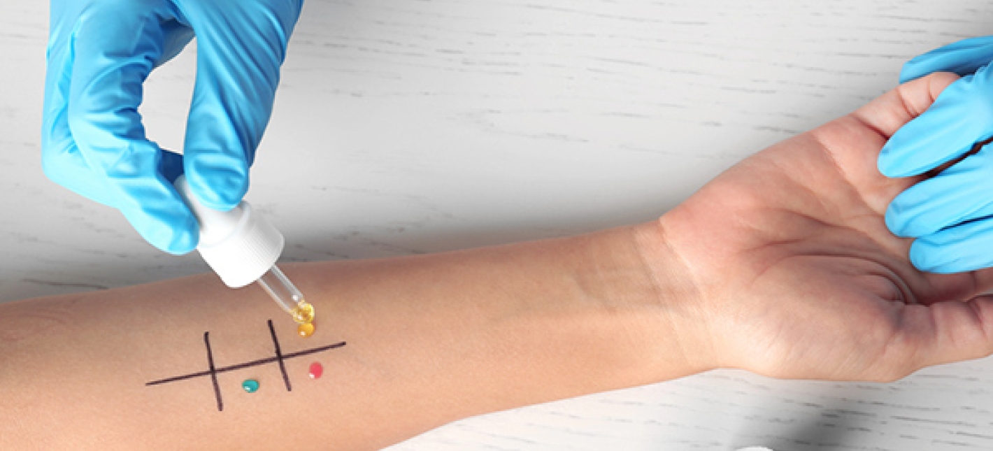 Консультация аллерголога